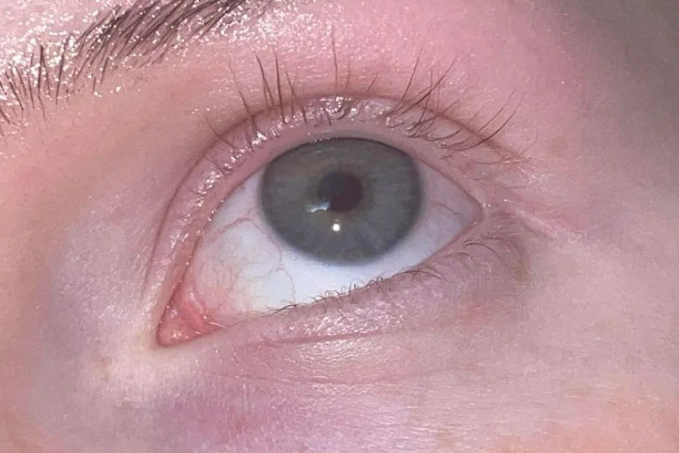 Wimpers voor gebruik van Lunevie wimperserum